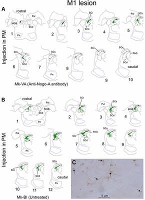 Corticotectal Projections From the Premotor or Primary Motor Cortex After Cortical Lesion or Parkinsonian Symptoms in Adult Macaque Monkeys: A Pilot Tracing Study